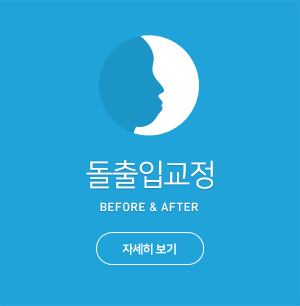 돌출입교정
