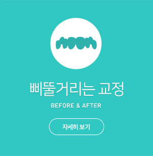 삐뚤거리는교정